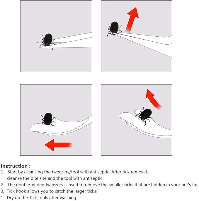 3 Pack Tick Remover Tool Set Stainless Steel Tick Remover Kit for Cats and Dogs