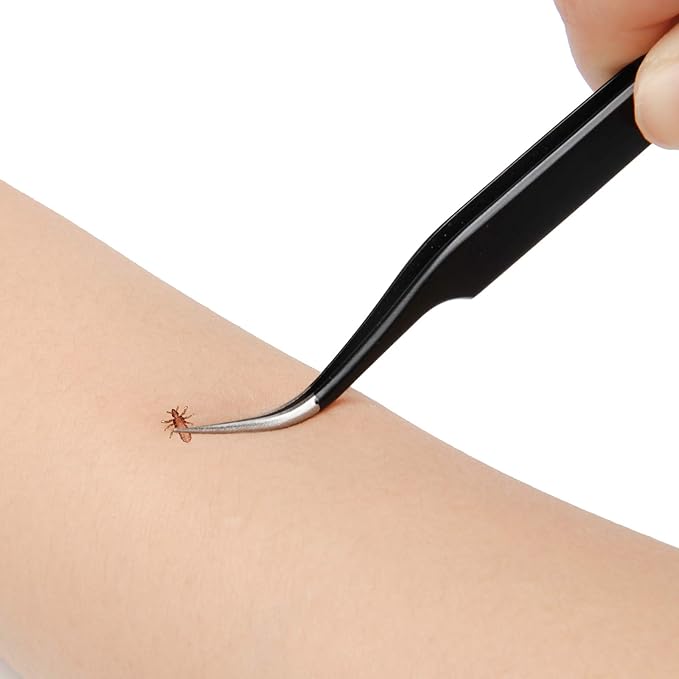 3 in 1 Tick Remover Kit, Black Tick Remover Tweezers Stainless Steel Tick Remover Tools Set for Pet Dog, Cat, Human with Storage Box (Black)